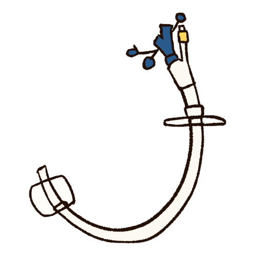 A drawing of a white G-tube with blue and yellow accents.